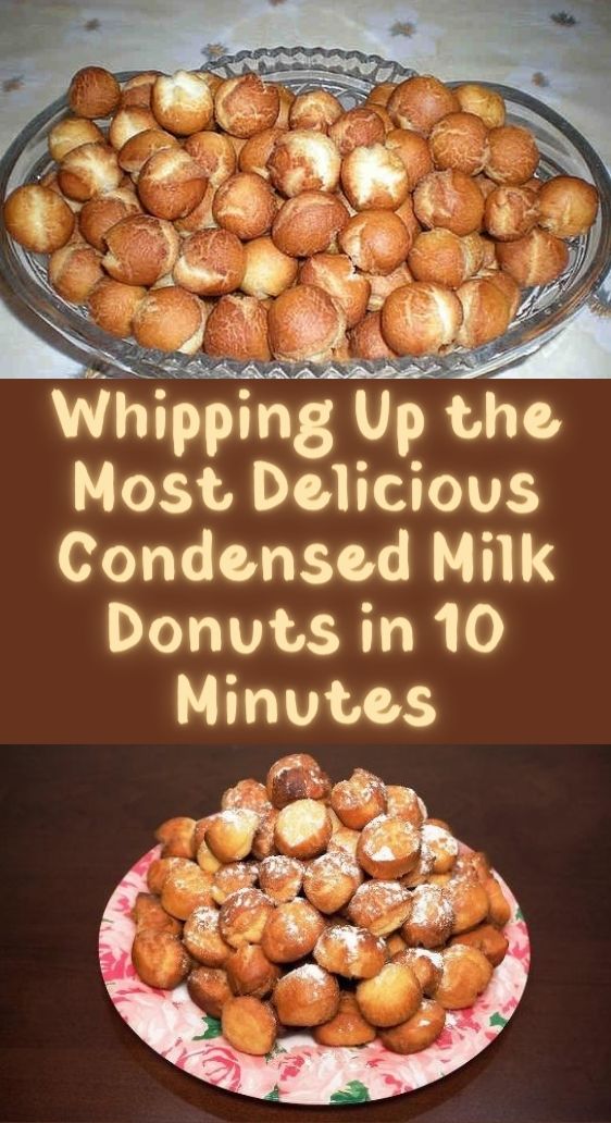 Whipping Up the Most Delicious Condensed Milk Donuts in 10 Minutes